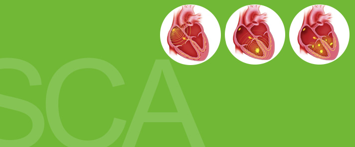 La parada cardiaca súbita no es lo mismo que un ataque al corazón La parada cardiaca súbita no es lo mismo que un ataque al corazón